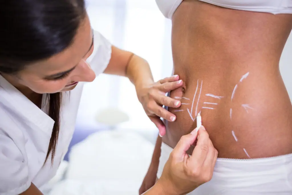 A provider marks a patient’s abdomen before a body treatment.