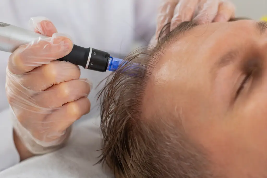 A provider treats a patient’s scalp.